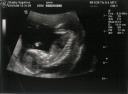 baby13.1-formindsket.jpg
